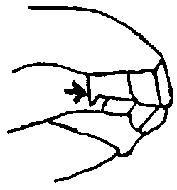 Image undefined