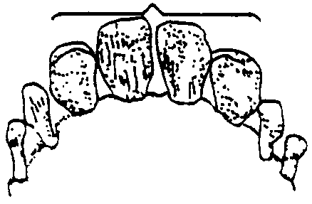 Image undefined