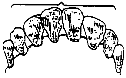 Image undefined