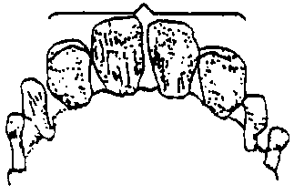 Image undefined