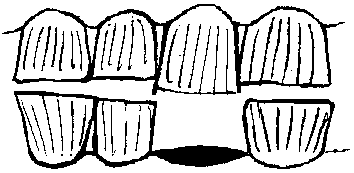 Image undefined